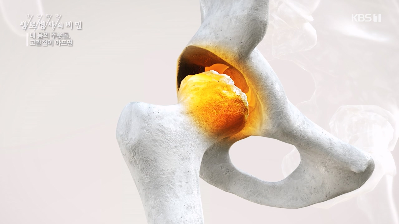 생로병사의 비밀.E890.231116p-NEXT.mp4_20231116_204848.778.jpg