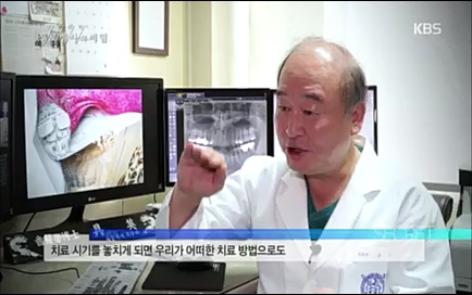 [670회] 생로병사의 비밀 - KBS670회] 생로병사의 비밀.ts_20220505_143154.279.jpg