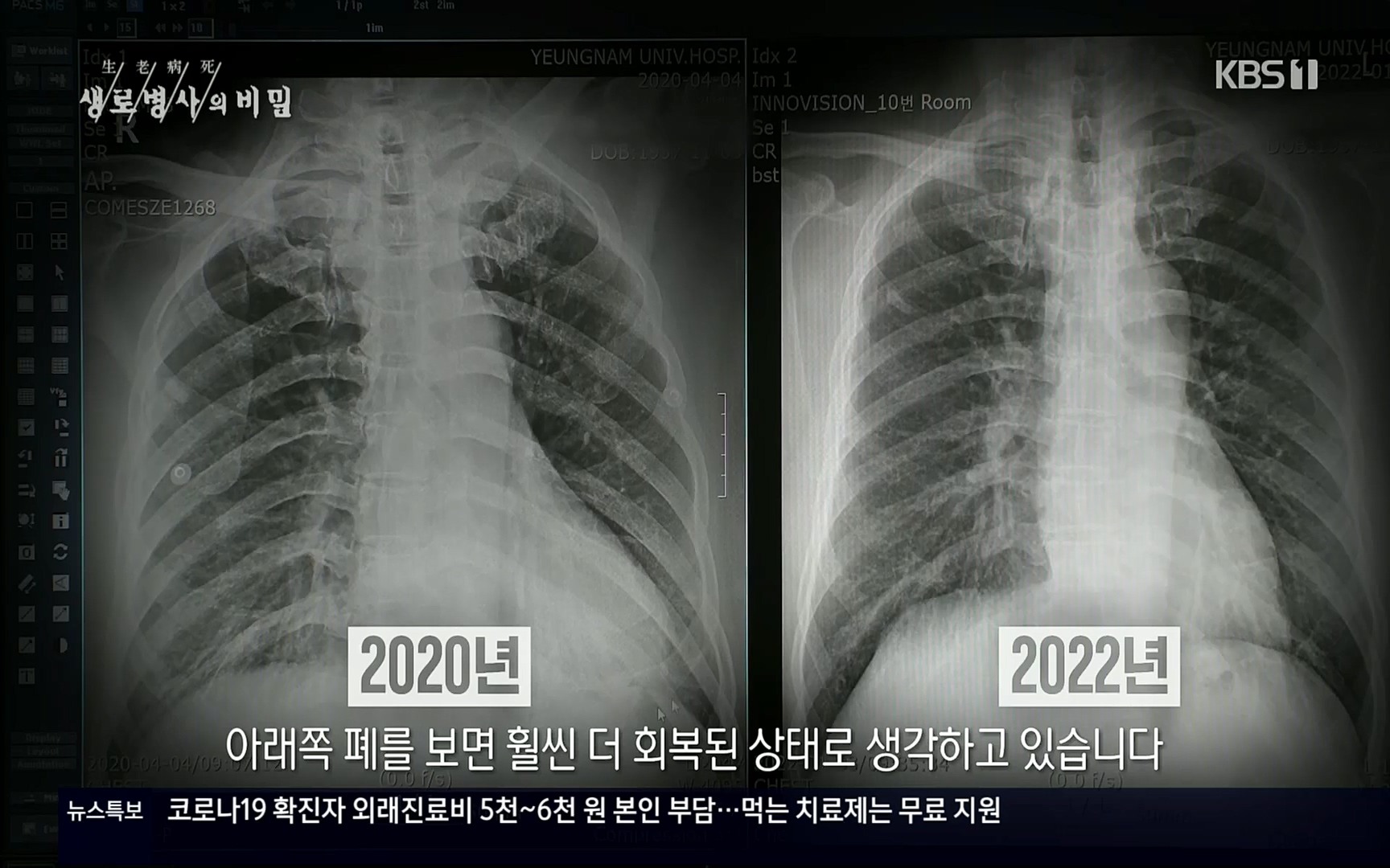 생로병사의 비밀.E827.220720p.H264-F1RST.mp4_20220721_203841.962.jpg