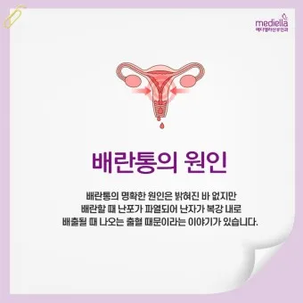 배란통 증상 및 시기 원인_23
