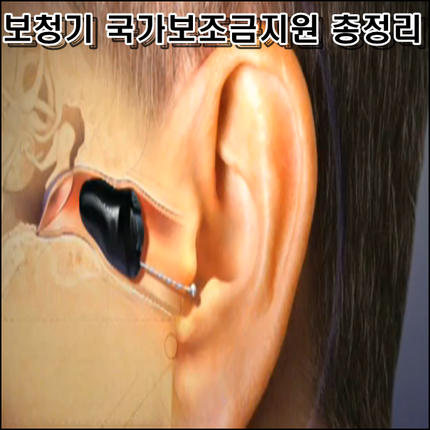  보청기 국가보조금지원 상세정리
