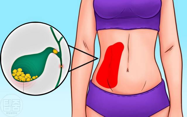 위치별 복통 원인 담석 복통 배 위치의 통증 위가 계속 아플 때