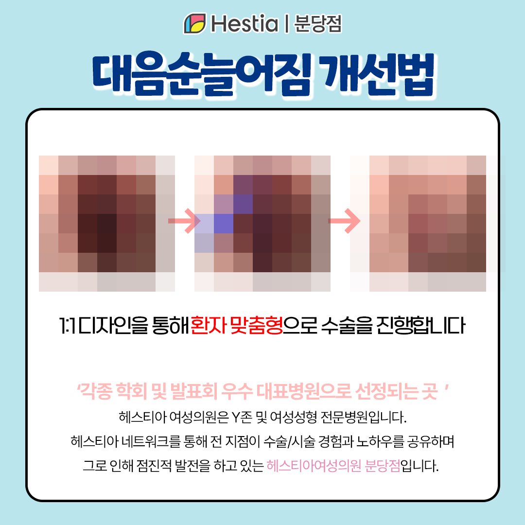 미금역산부인과 외음부미백 대음순늘어짐 대음순늘어짐 이렇게 개선