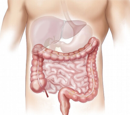 담석증 원인 증상 치료 방법 좋은 음식-13 담석증 원인 증상 치료 방법 좋은 음식-13