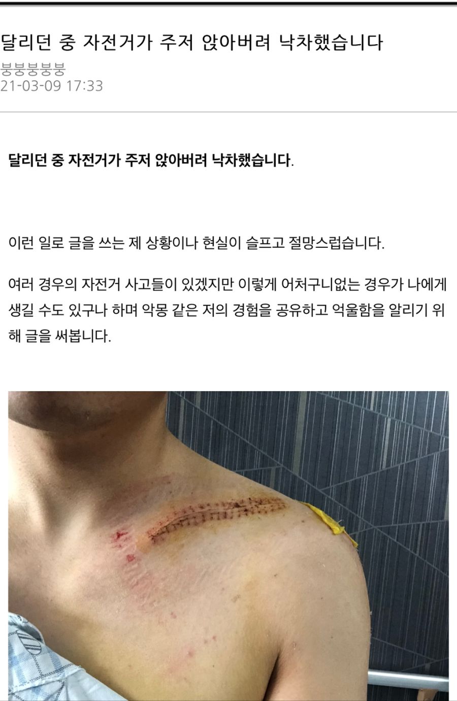  1,350만원짜리 자전거 타는 도중 박살남