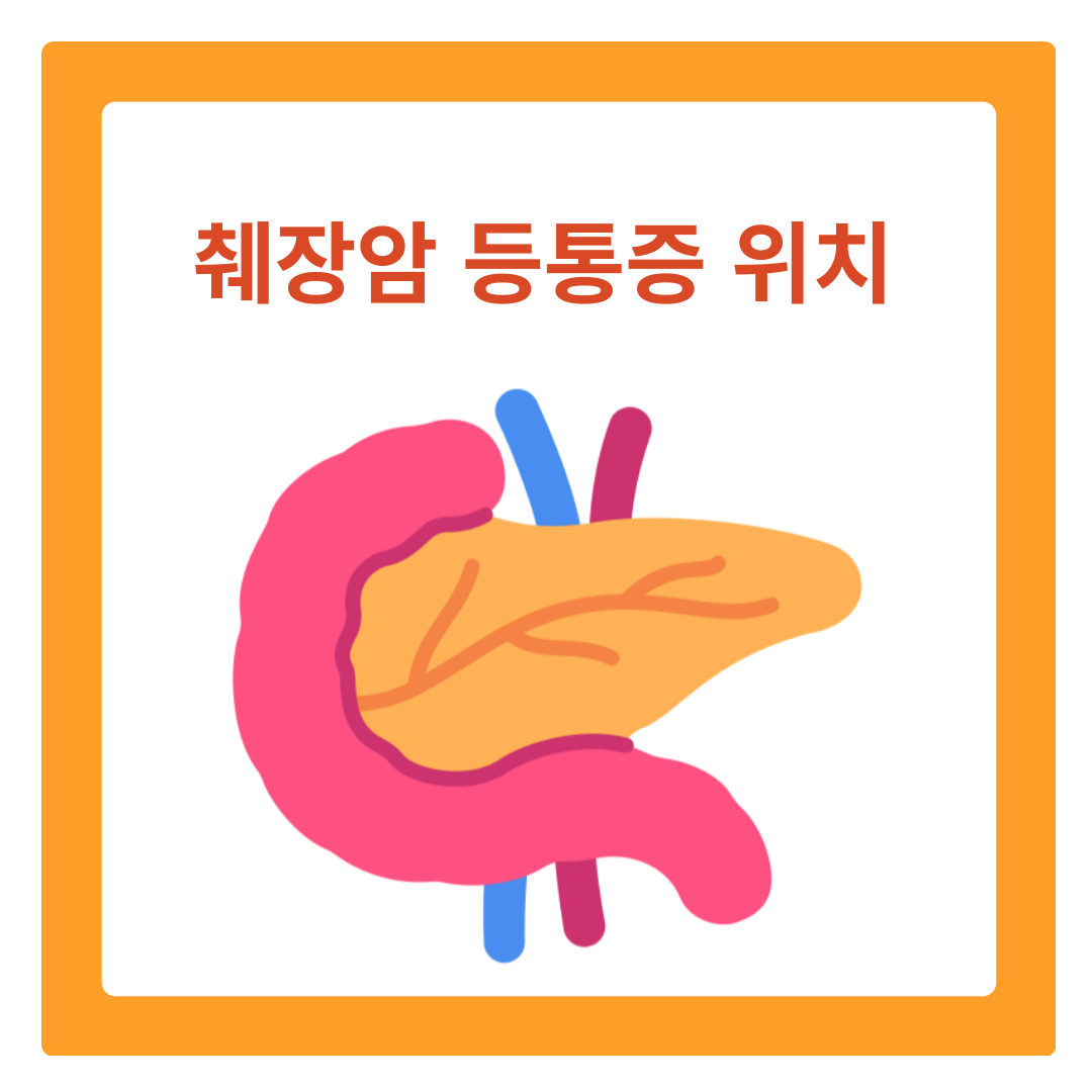  췌장암 등 통증 위치 및 췌장 위치 역할