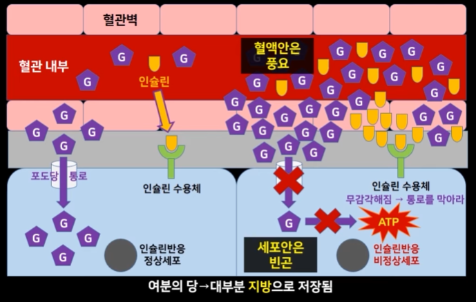 인슐린-저항성-원리