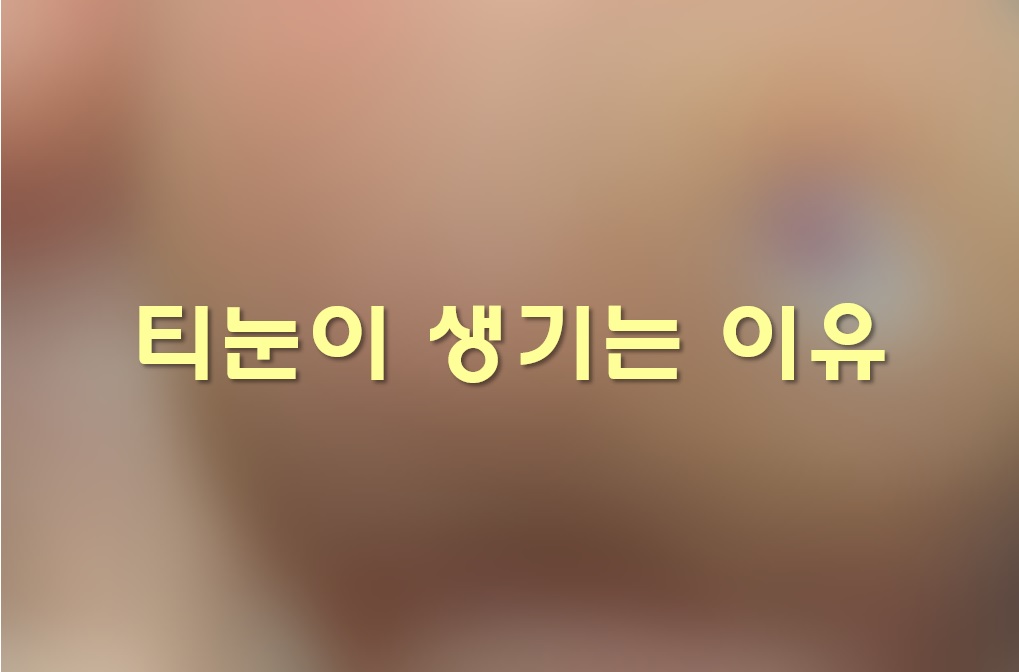  티눈 생기는 이유와 발바닥 티눈 사마귀 구별 방법