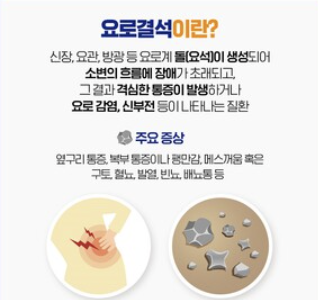 요로결석 증상 10가지 총정리 섬네일