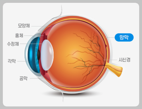 망막 이상 전조증상