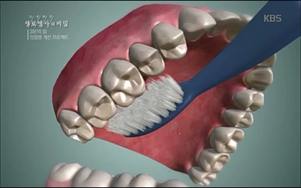 [670회] 생로병사의 비밀 - KBS670회] 생로병사의 비밀.ts_20220505_143200.465.jpg