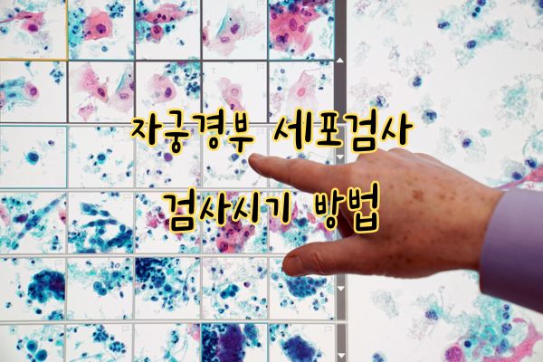 자궁경부 세포검사 검사시기 방법