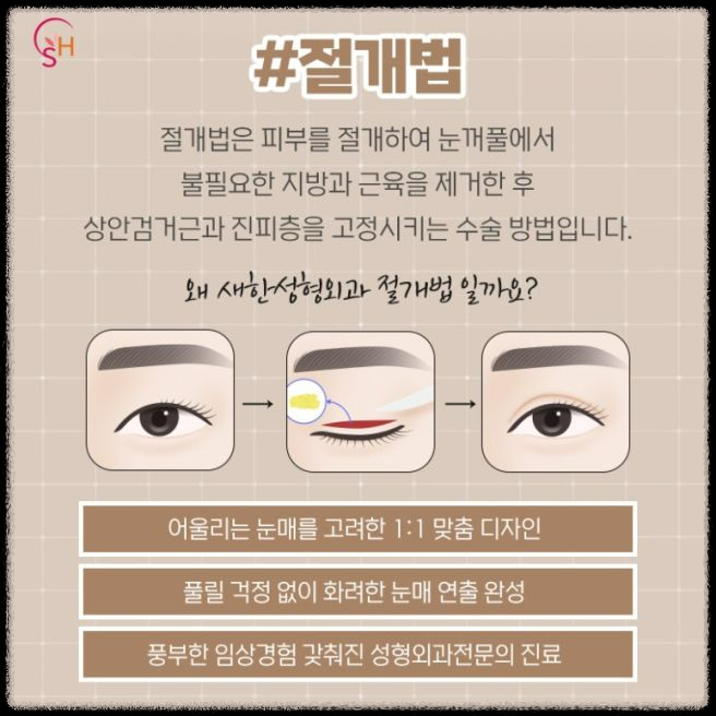 중년의 눈처짐, 쌍꺼풀 수술로 해결할 수 있을까요?