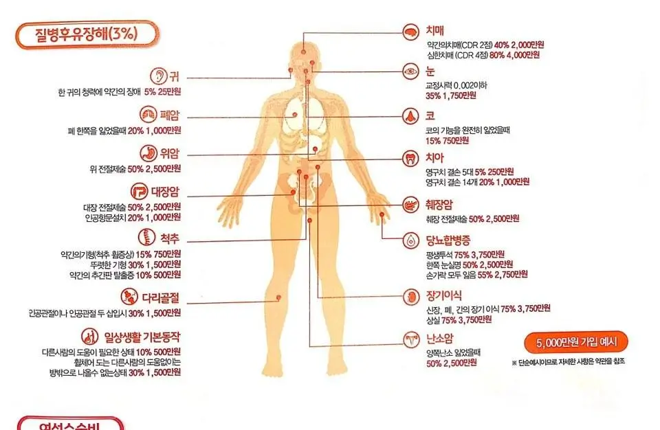 후유장해