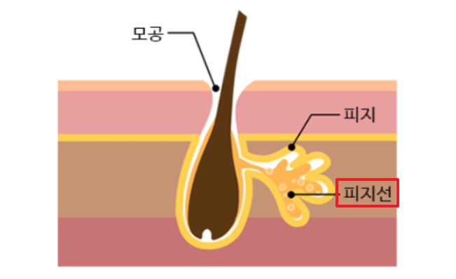 여드름의 원인-피지선-피지-모공 그림