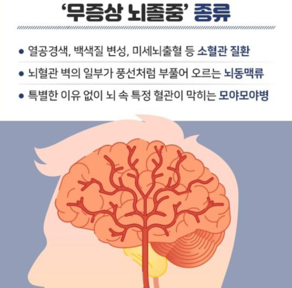 뇌졸중 전조증상과 체크리스트 및 예방과 치료