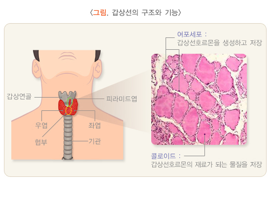  갑상선 결절