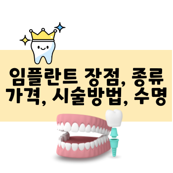 임플란트 가격 종류 수명 시술방법