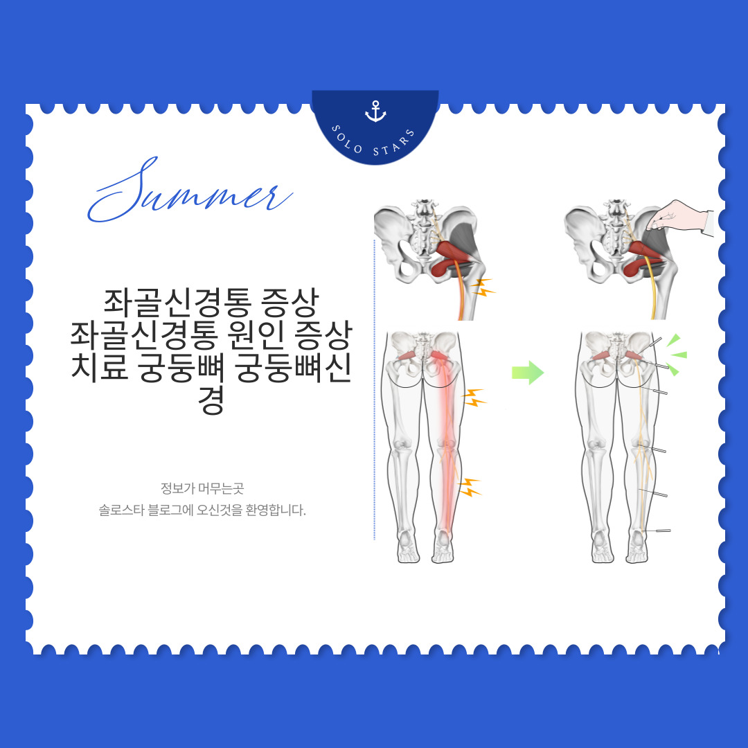 좌골신경통 그림