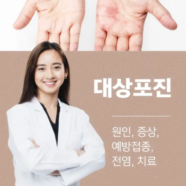 대상포진 원인&amp;#44; 증상&amp;#44; 예방접종&amp;#44; 전염&amp;#44; 치료