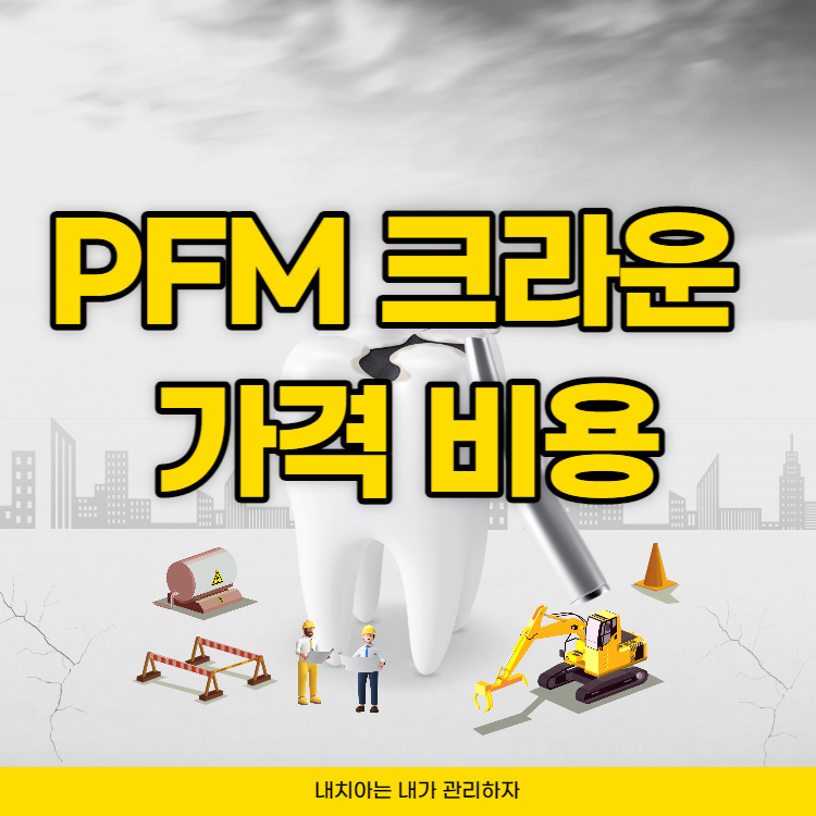 PFM-크라운-가격