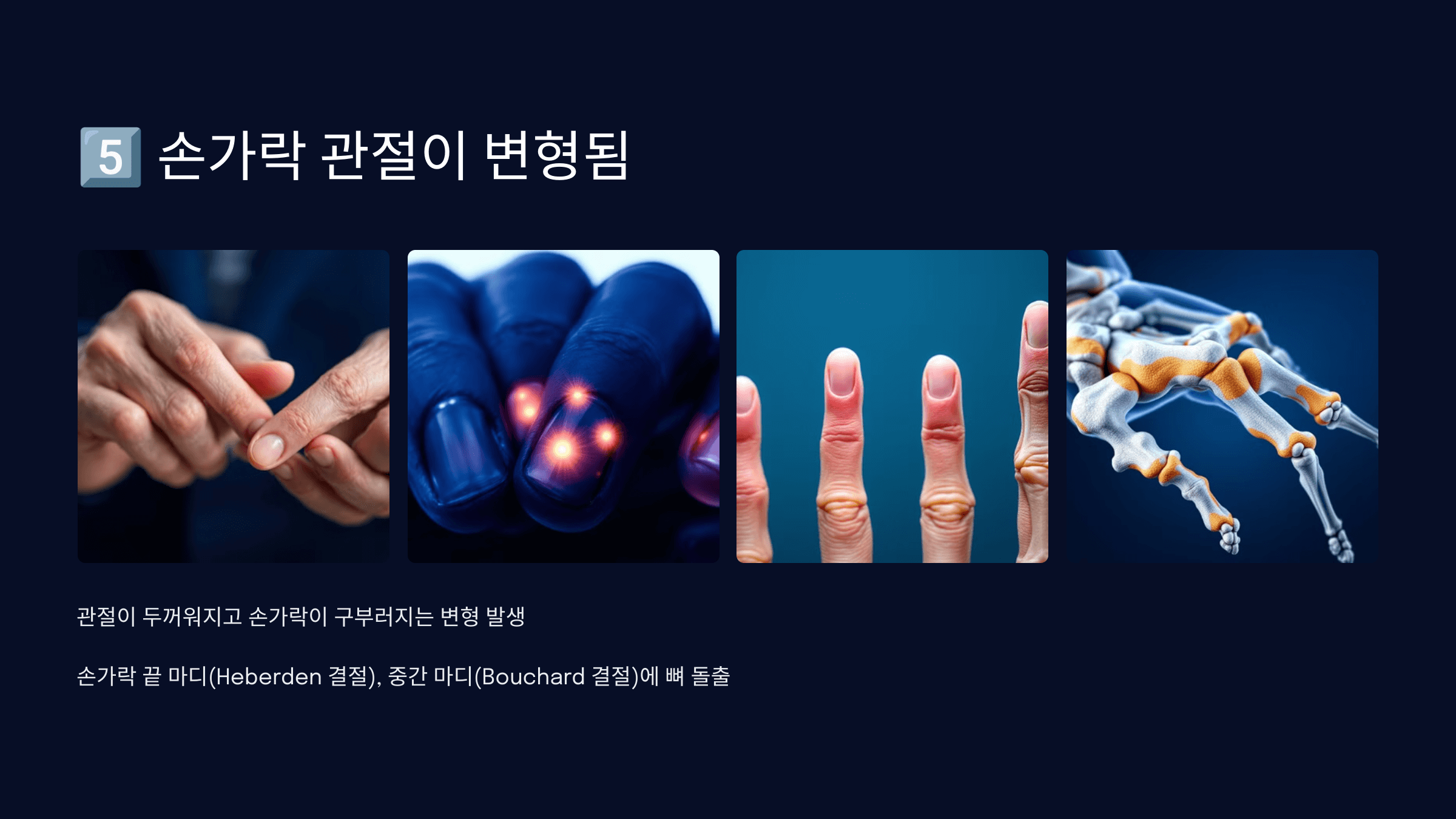 손가락 관절염과 관련된 사진입니다.