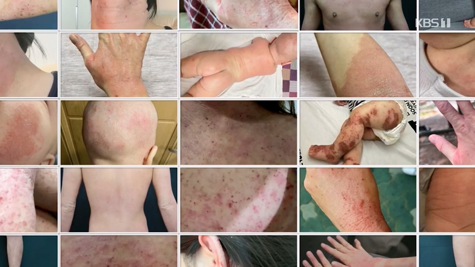 생로병사의 비밀.E872.230628p.H264-F1RST.mp4_20230707_214222.784.jpg
