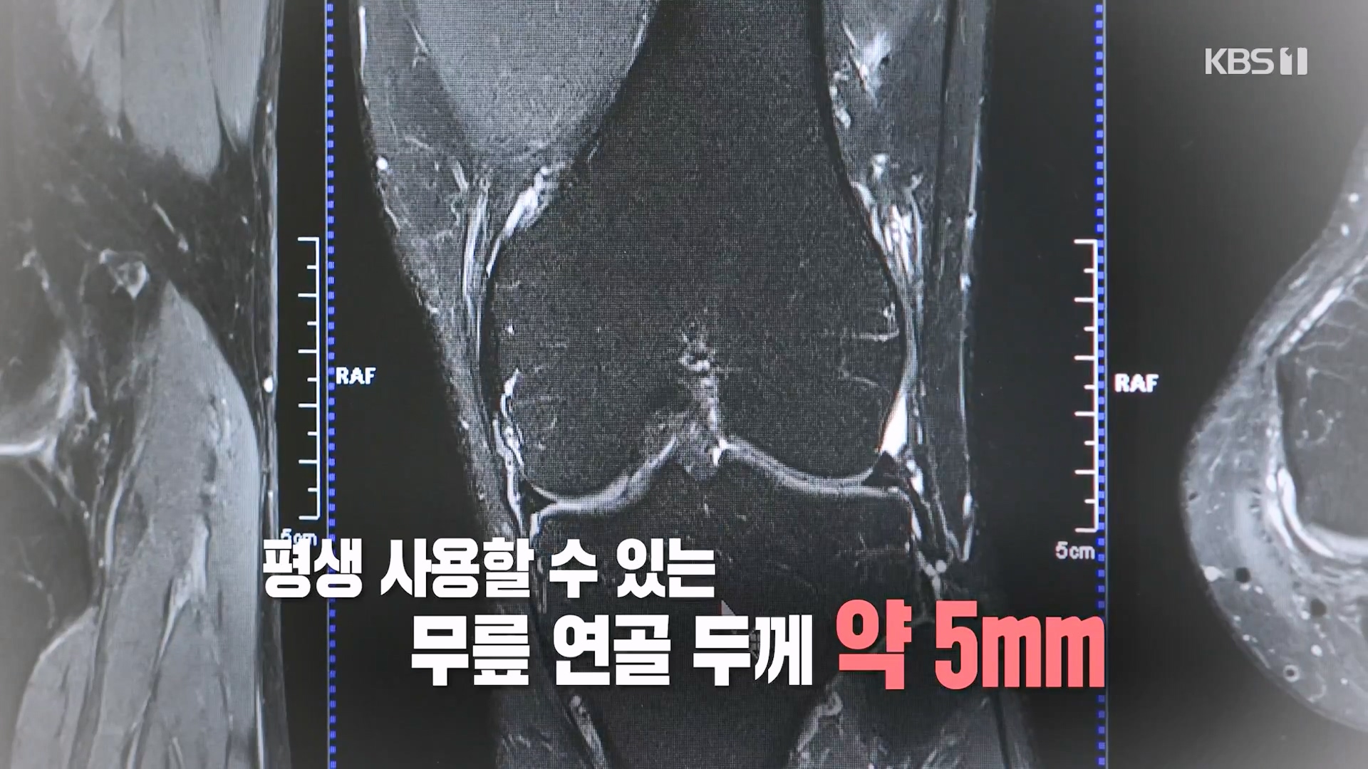 생로병사의 비밀.E873.230607p-NEXT.mp4_20230608_195112.797.jpg