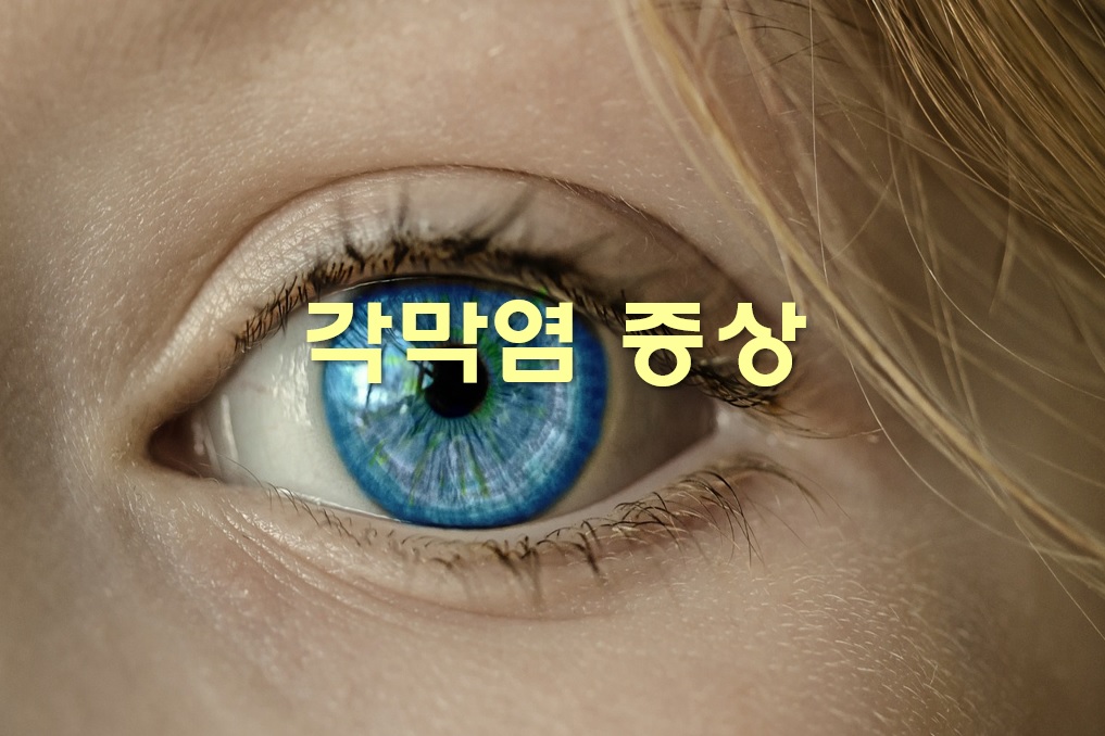 각막염 증상과 원인, 각막염 치료법