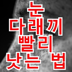  눈 다래끼 원인과 빨리 낫는 법