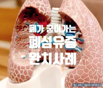 폐섬유증 초기 증상 치료법 관리방법_18