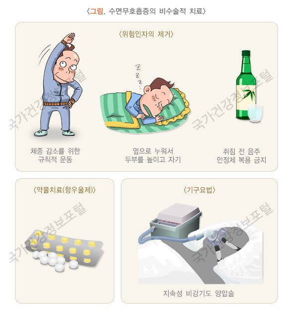 머리가 아플 때, 수면 무호흡 증상이 수면 부족 두통을 부른다? 2