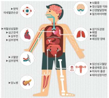 미세먼지 농도&#44; 관련 질환