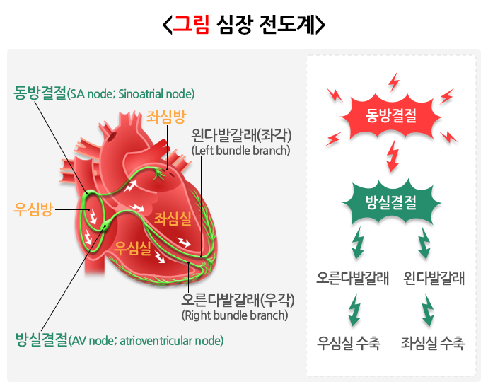 중풍 검사 방법 6가지