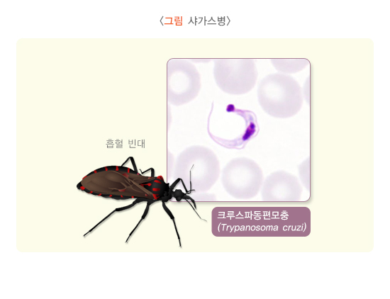  샤가스병
