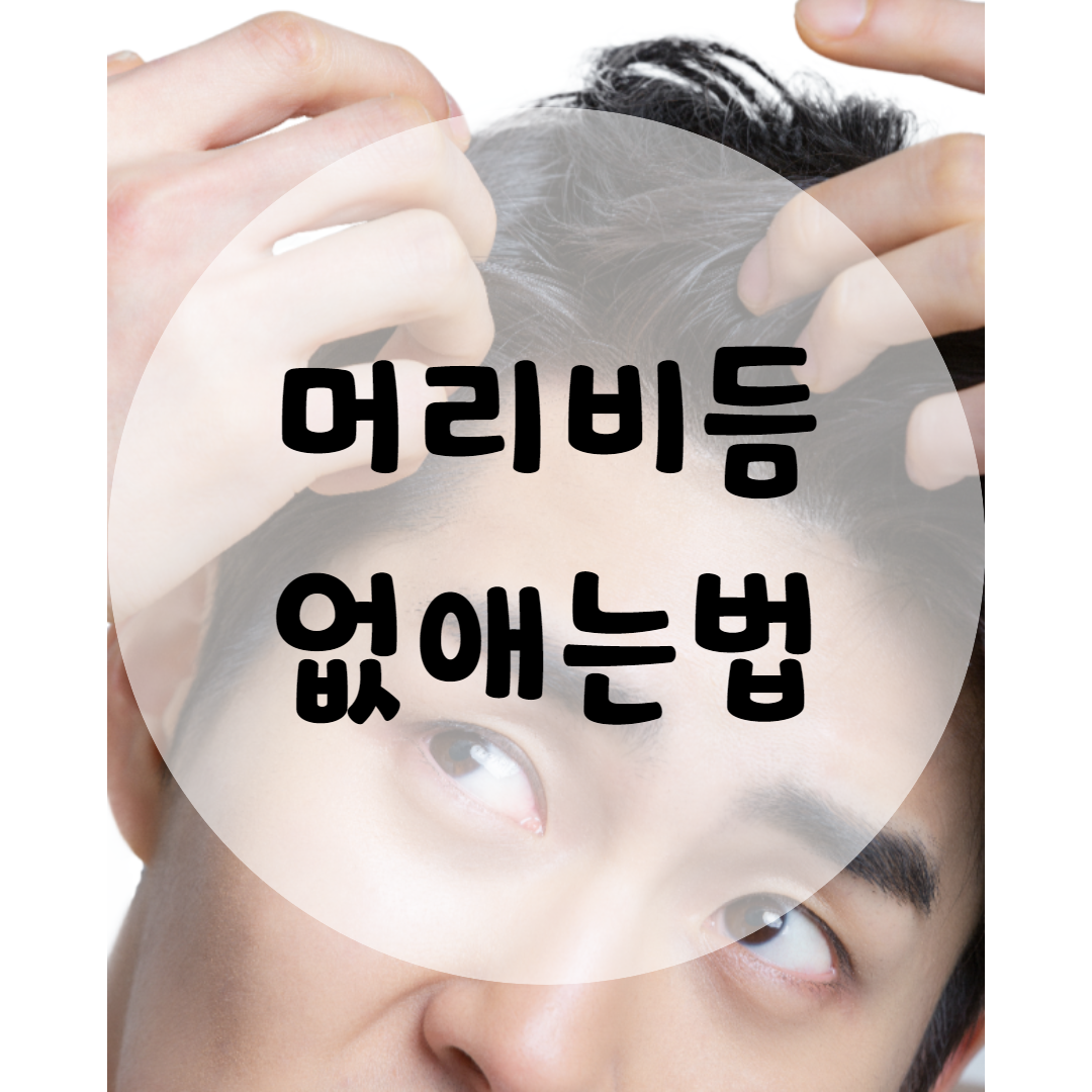 머리비듬없애는법 좋은 천연재료