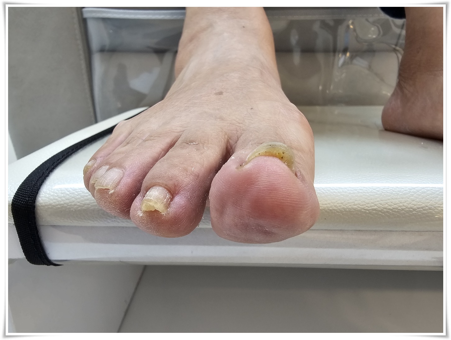 발데렐라 이미지