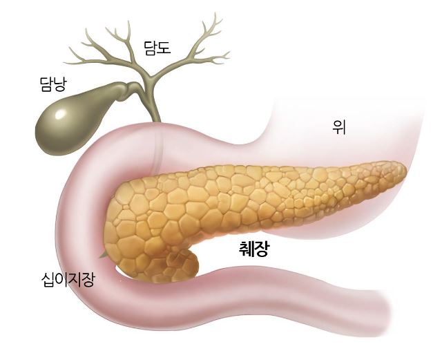 졸링거 엘리슨 증후군 (Zollinger Ellison Syndrome)