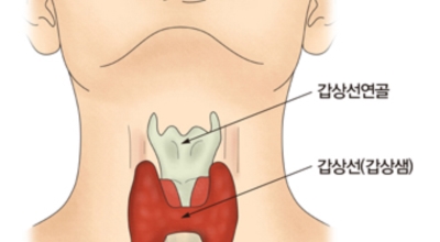 갑상선 이미지