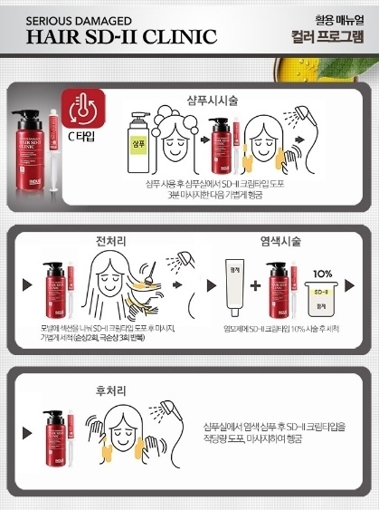 시술 방법
