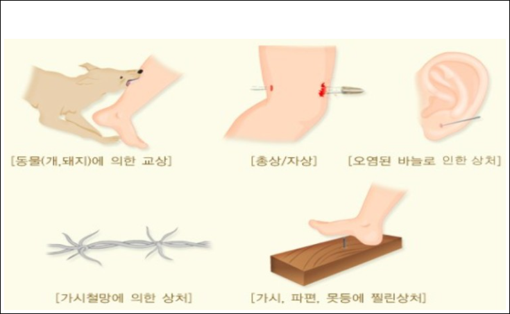  파상풍 증상 예방접종 시기