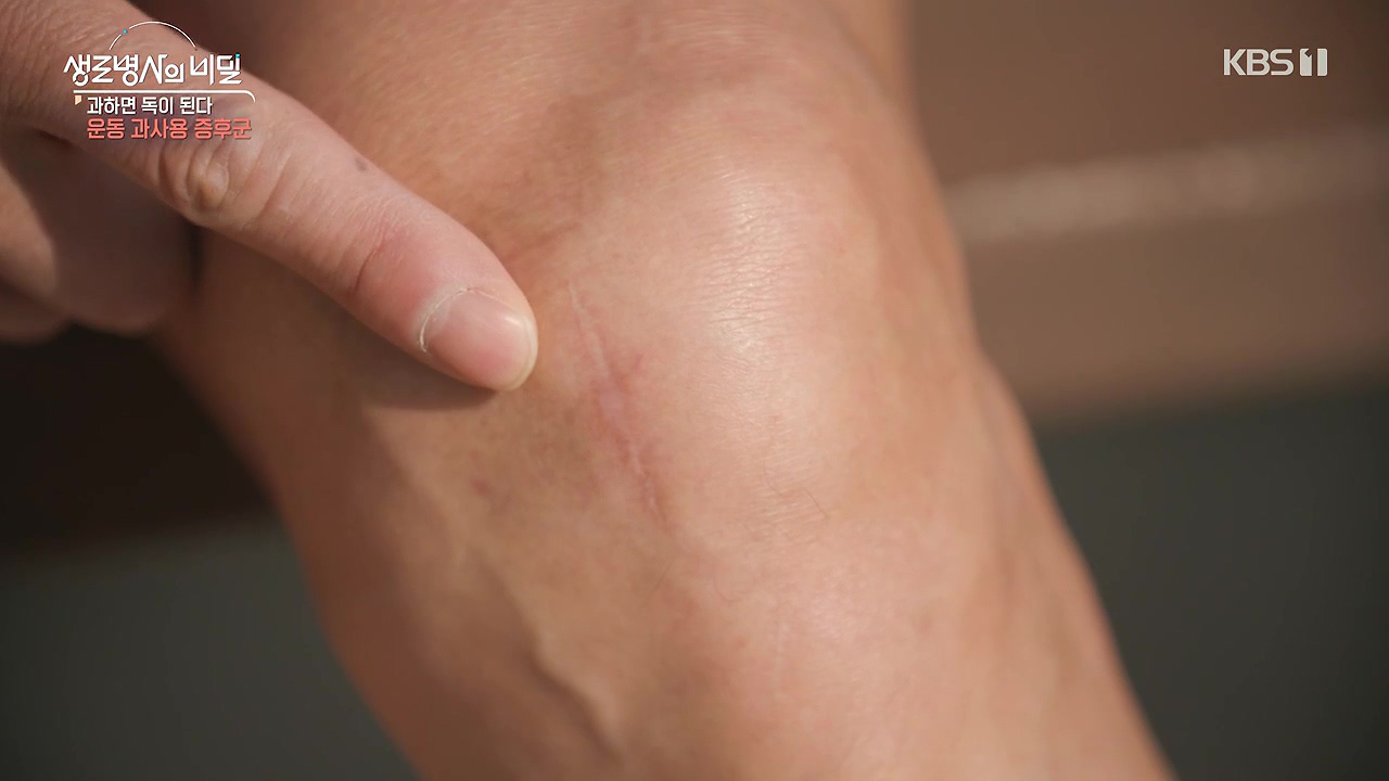 생로병사의 비밀.E918.240704p-NEXT.mp4_20240704_195405.275.jpg