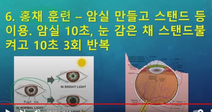 홍채운동