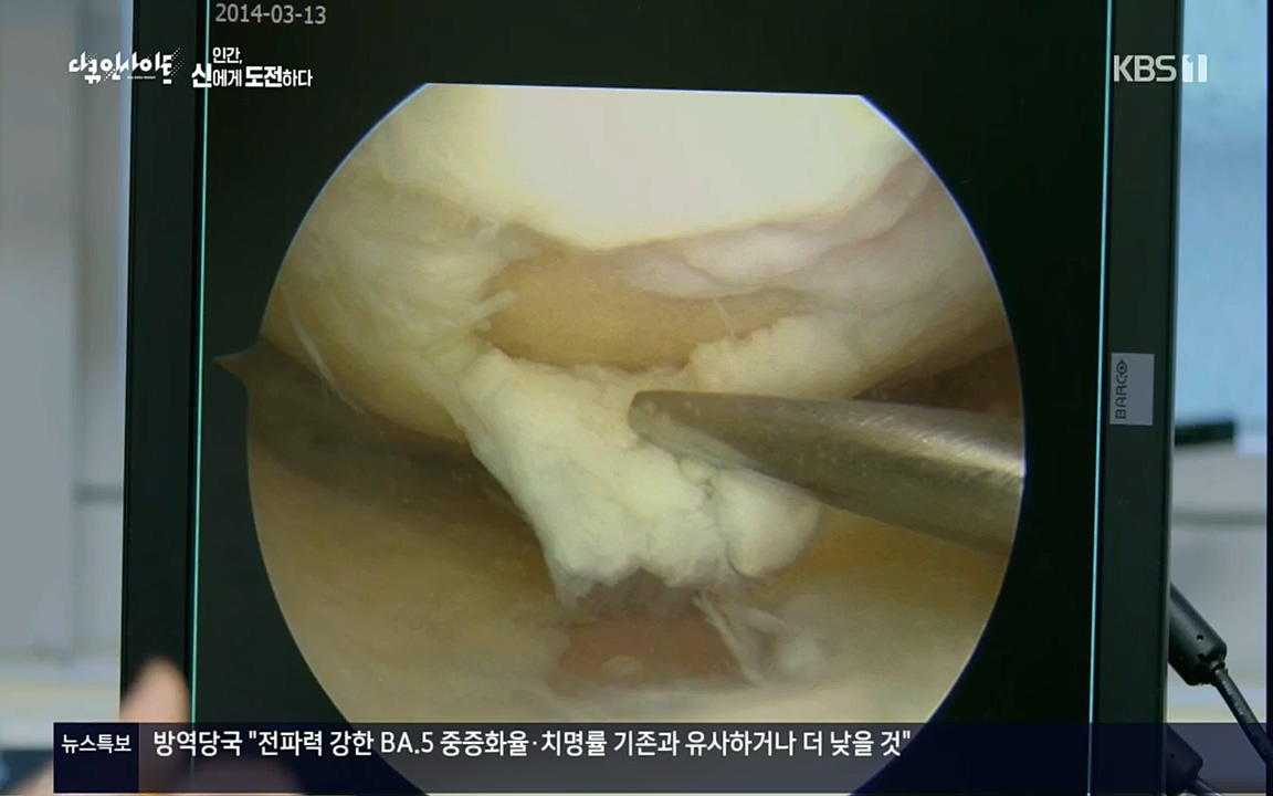 다큐 인사이트.E121.220819p.H264-F1RST.mp4_20220822_180817.877.jpg