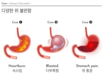 속쓰림 원인 증상 치료하는 방법_10