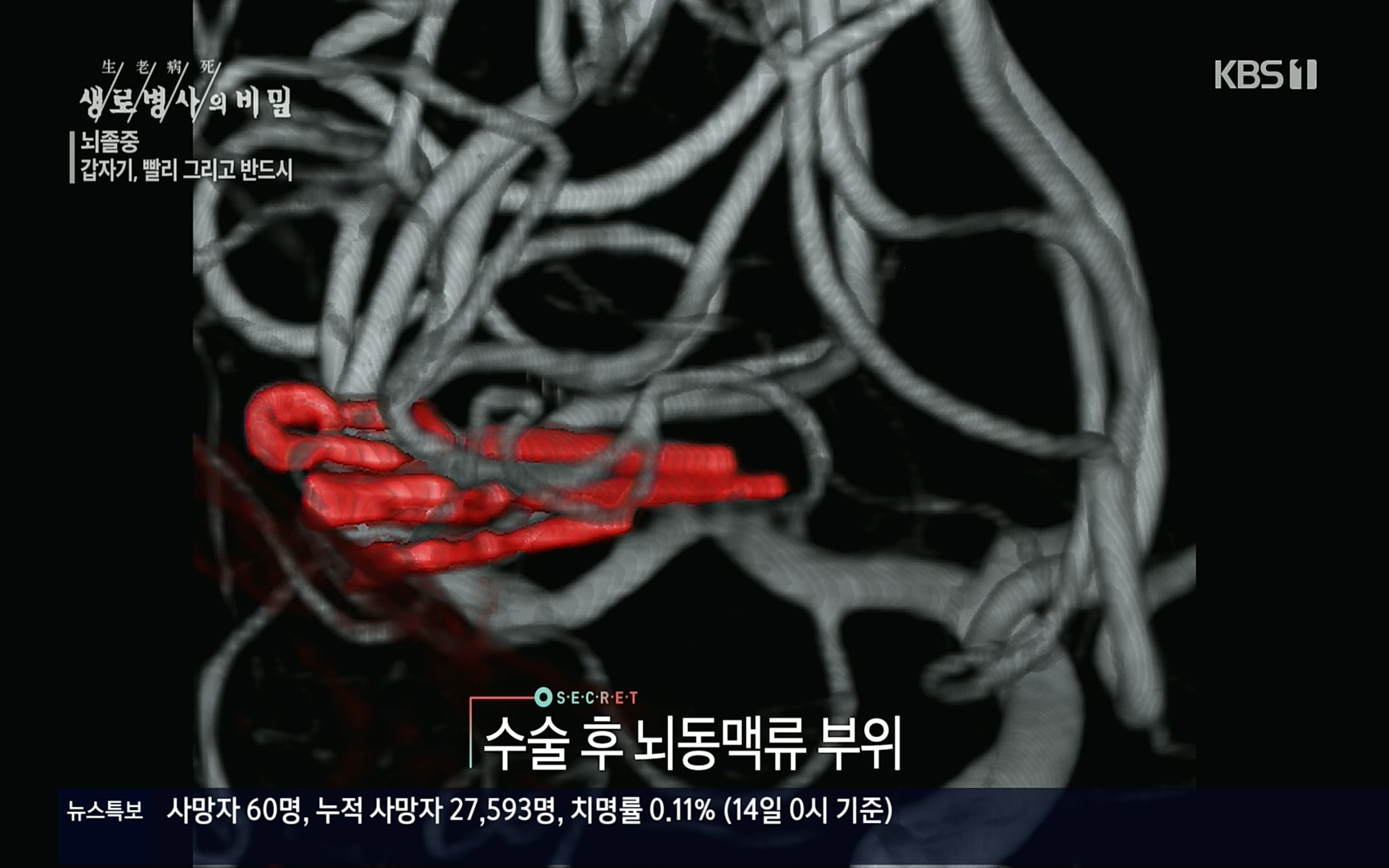 생로병사의 비밀.E835p.H264-F1RST.mp4_20220917_181743.731.jpg