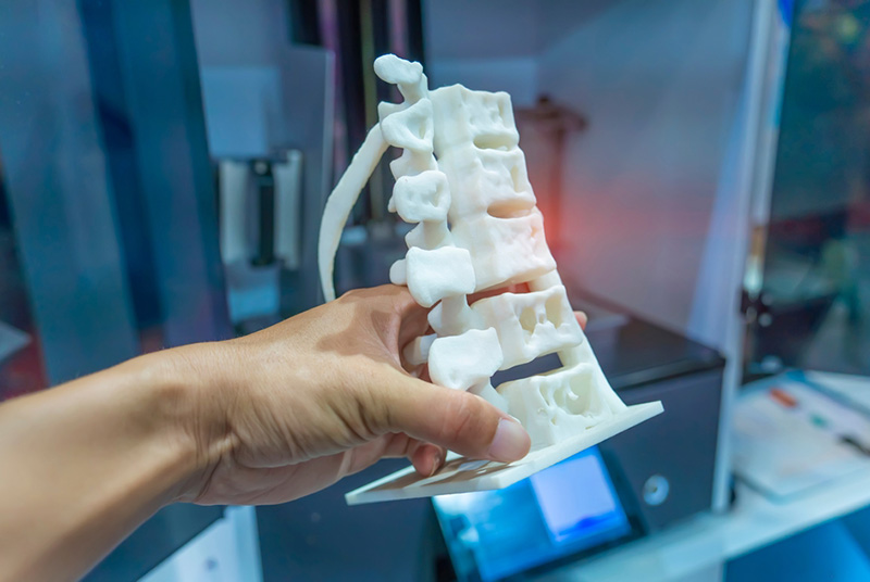 PC소재로 3D프린팅 제작한 대형 뼈 모형