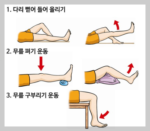 관절수술재활