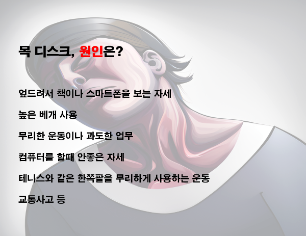  목 디스크 판정... 치료법은?