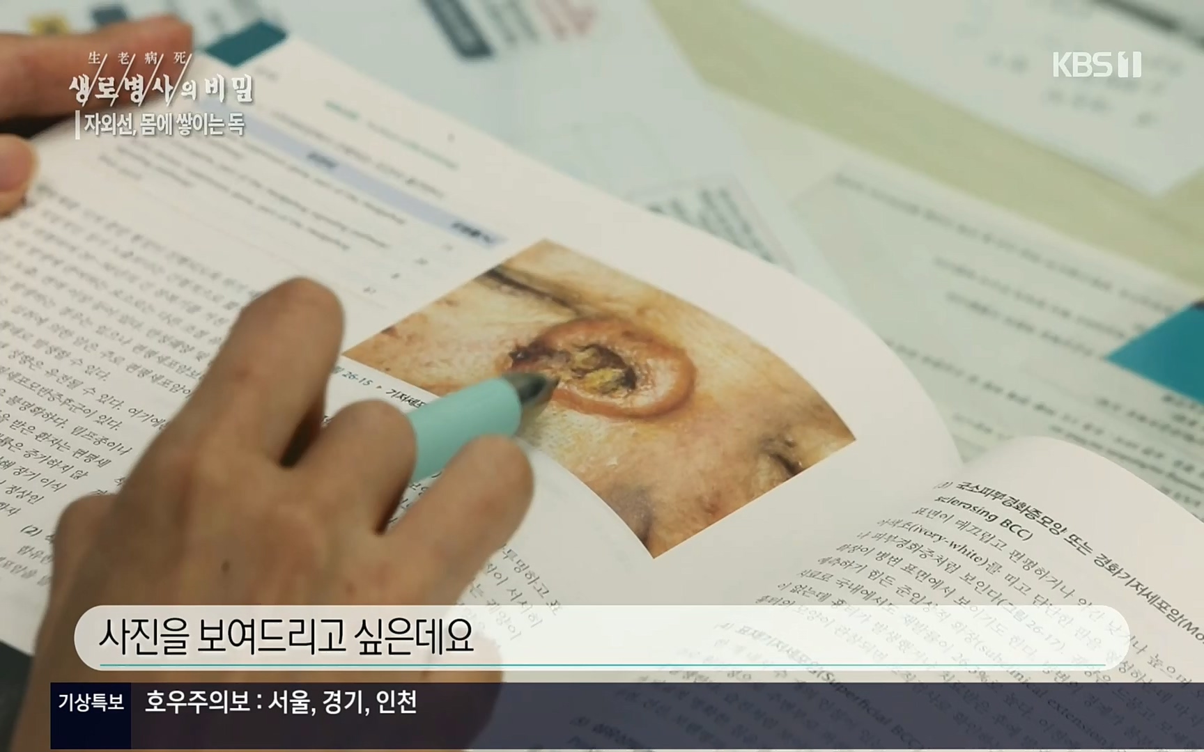 생로병사의 비밀.E824.220629p.H264-F1RST.mp4_20220630_205905.103.jpg